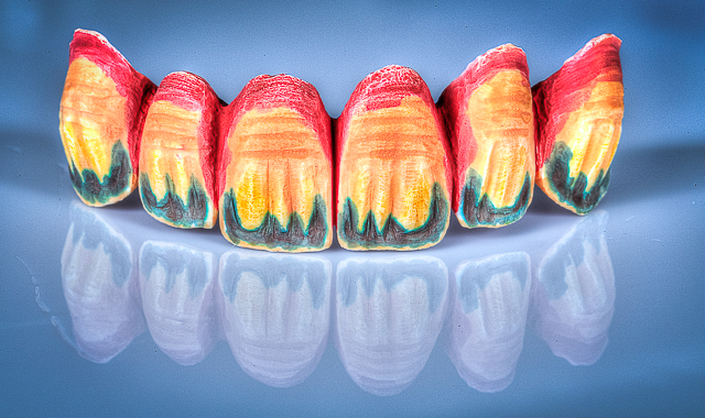 IMG_0932_tonemapped-1.jpg
