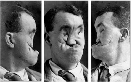 Rifleman Moss without his mask - photos courtesy of IWM Archives.