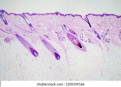 cross-section-human-skin-head-260nw-1205199166.jpeg