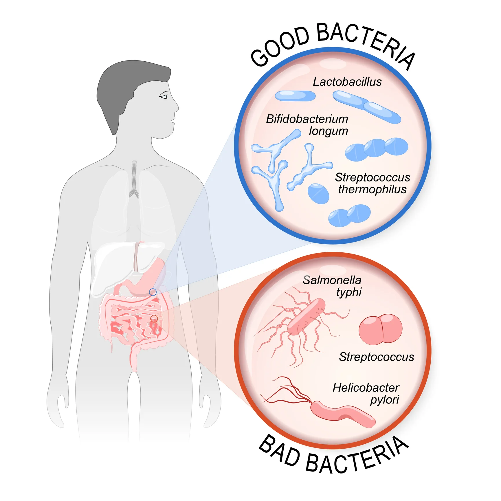 how to build a healthy gut good vs bad bacteria photo.jpg