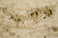 Aspergillis sp., bread mold, mycelia and spores visible