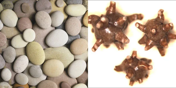 Left side: how people think kidney stones look. Right side: one of many shapes they can actually take. 