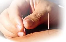 Dry needling-one of many chiropractic techniques used at Colac Chiropractors