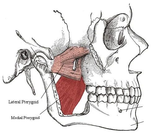 These are the muscles we're working on inside the mouth. See how the cheekbone and a chunk of the jaw are cut away in this view? Working around them is why we have to work inside the mouth.