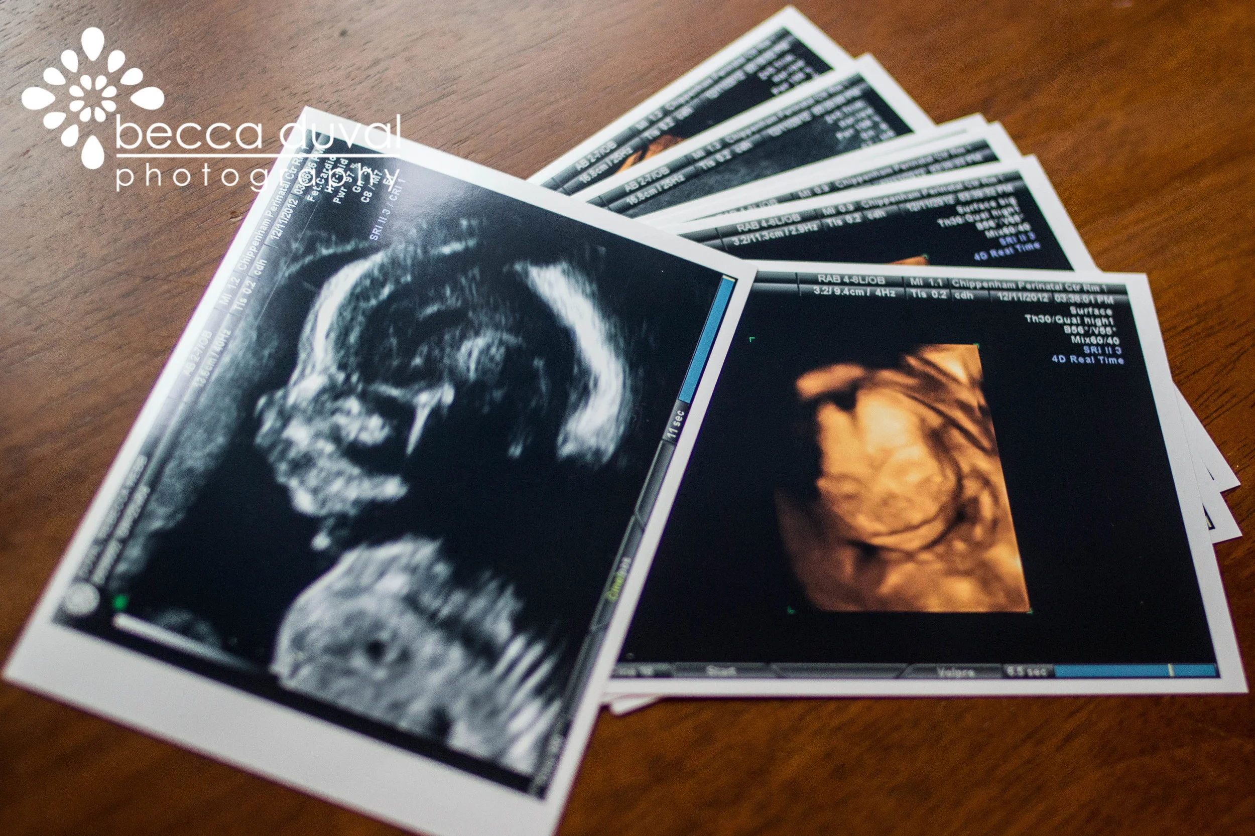 Baby E - Ready for his close up!
