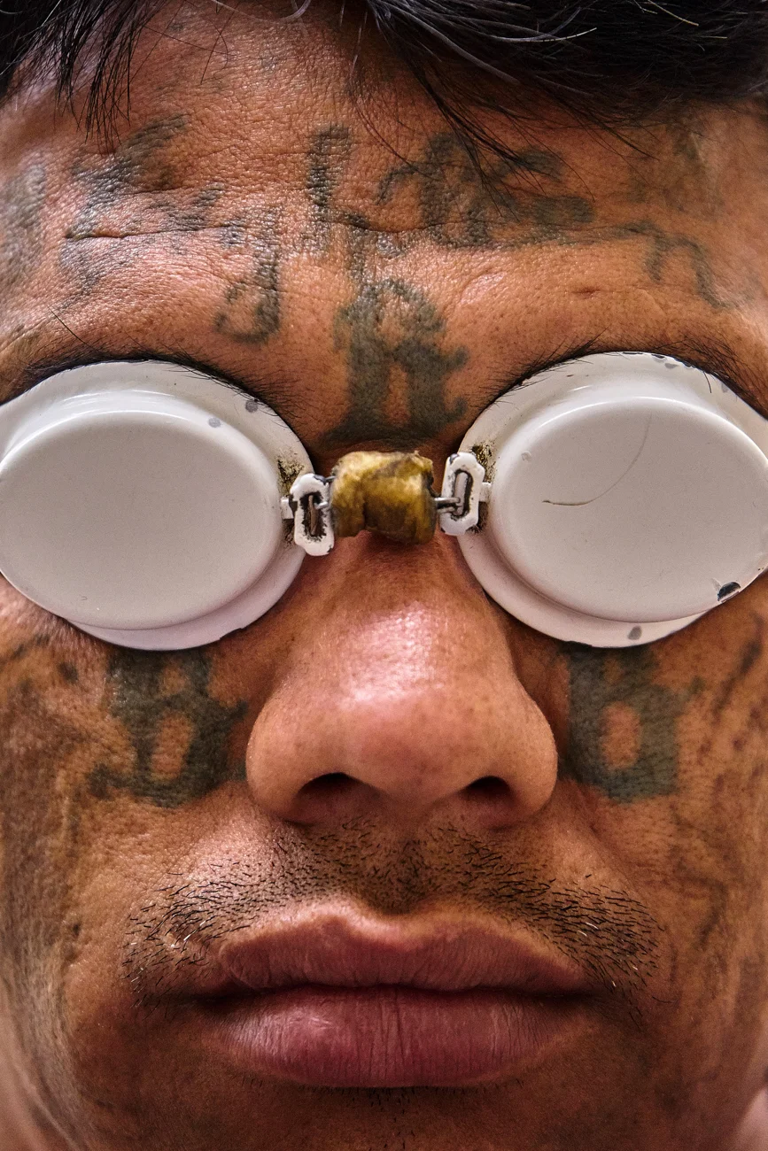  Raul, an ex 18th Street gang member, waits to undergo a laser removal session for some of his many tattoos. After serving time in San Francisco Gotera prison, Raul left gang life behind to raise a family and become a pastor. 