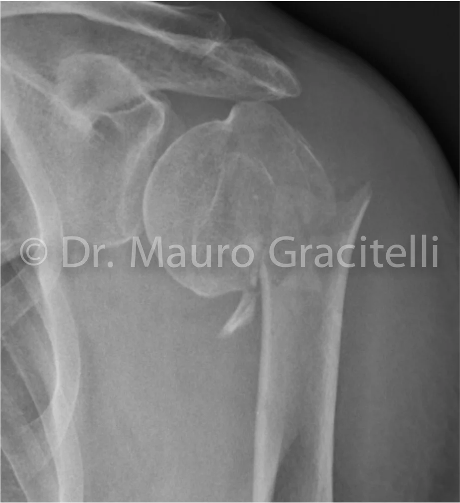 Radiografia