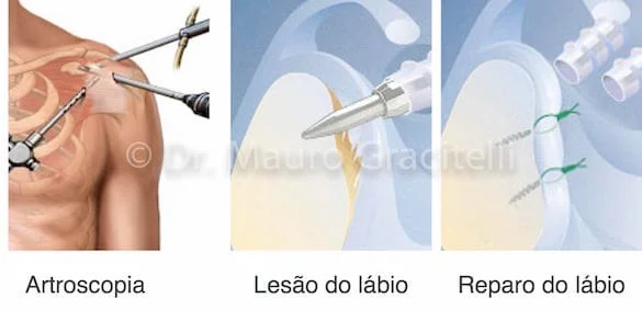 luxacao 05.jpg