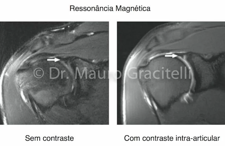 Ressonância magnética