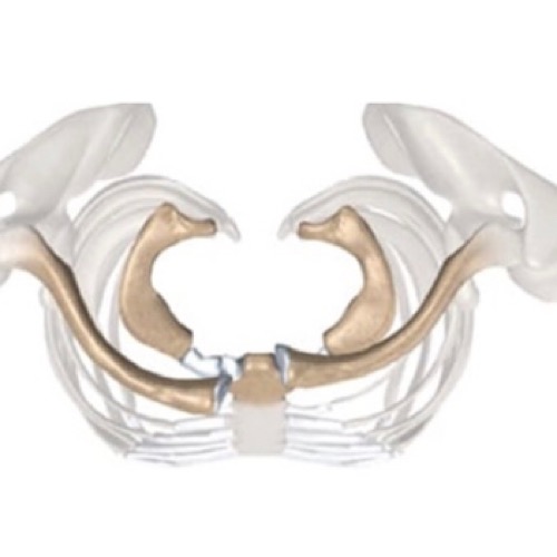 Luxação esternoclavicular