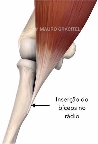 Lesões do tendão do bíceps no cotovelo (bíceps distal)