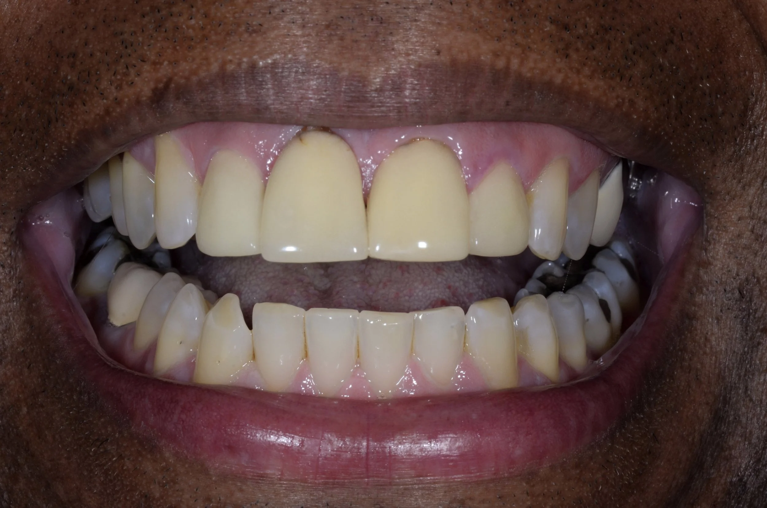 Wellington, Florida Cosmetic Dentist Marianna Kaufman