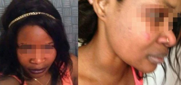 Marie-Reine, agressée par la police à Agen parce que noire, sa plainte classée sans suite