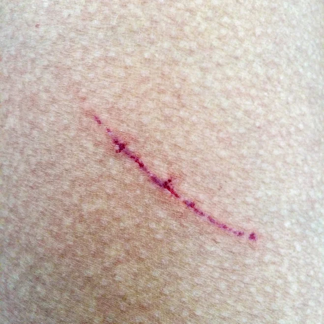 Dani Soter, Blessure , 2018 40 × 40 cm, photographie digitale, 2+5Courtesy of the artist & Maëlle Galerie, Paris