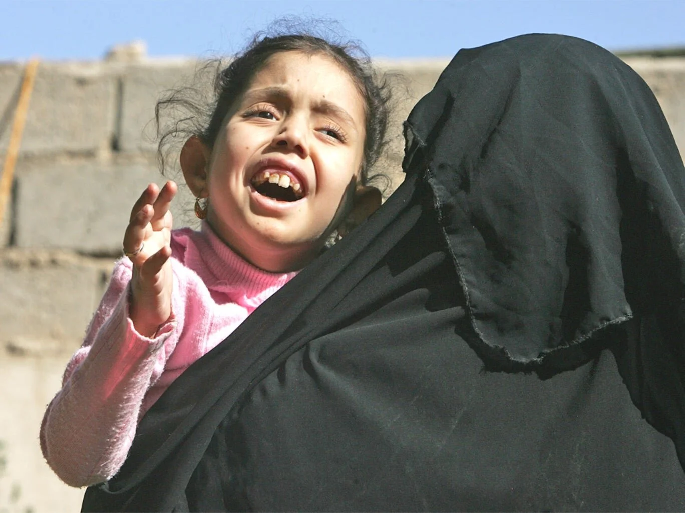 Les malformations congénitales et l'héritage toxique de la guerre en Irak