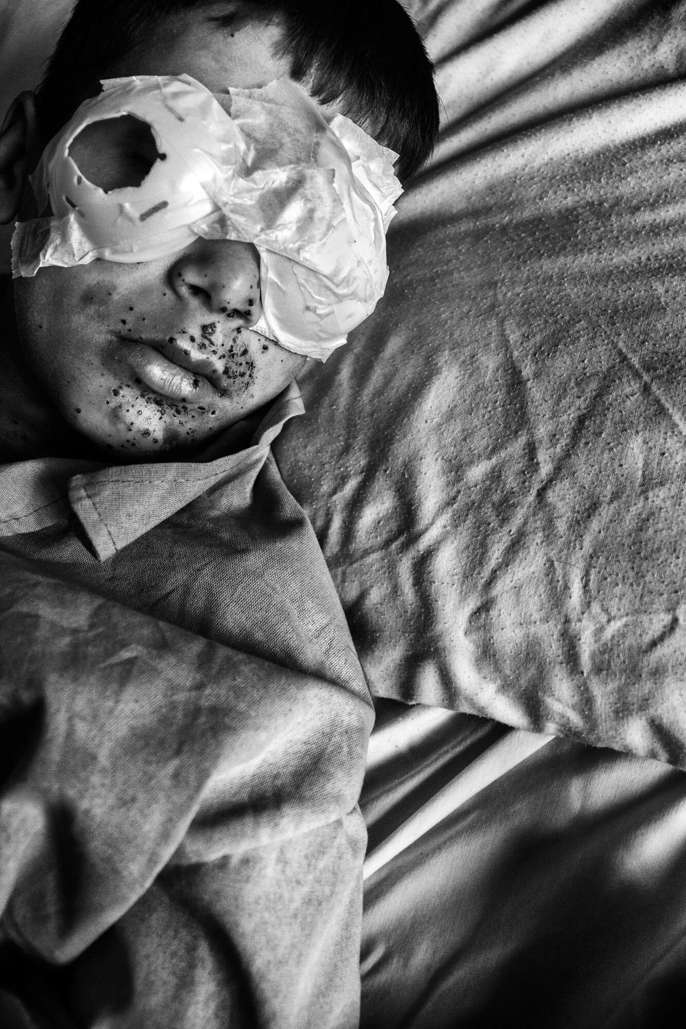 Sans titre. En mai 2013, Kamkar Osmani a été blessé par une mine enterrée qui datait de la guerre Iraq/ Iran à Sardasht, au Kurdestan iranien. Il y a perdu son œil gauche à 12 ans © Farshid Tighehsaz