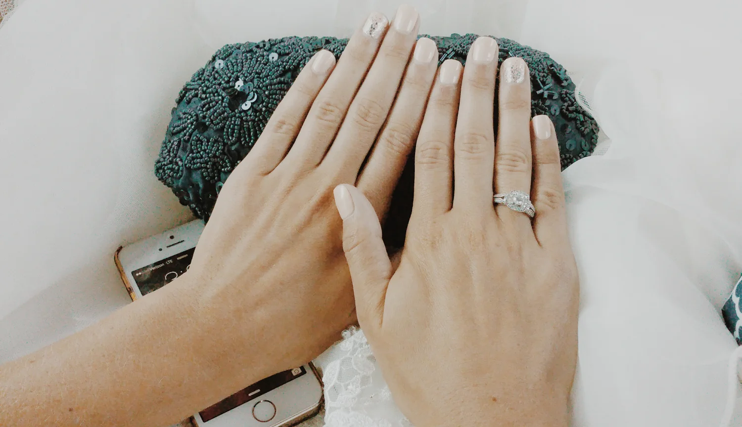 Betsy's hands are prepared for the slipping on of her new band. 