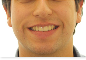 2Orthodontics Dean after.png