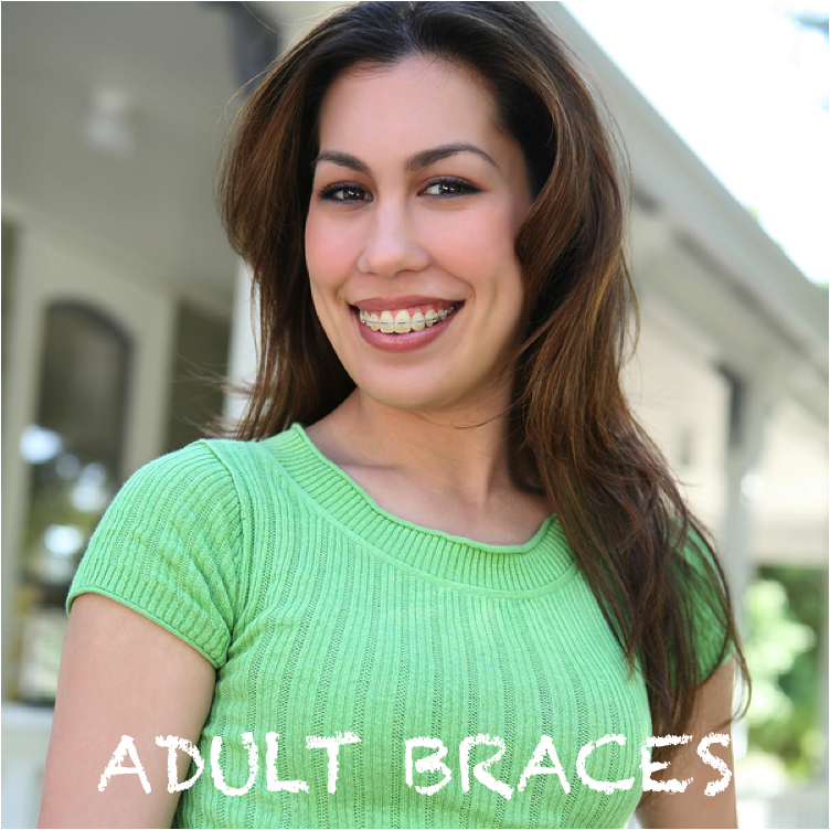More adults are wearing braces today!