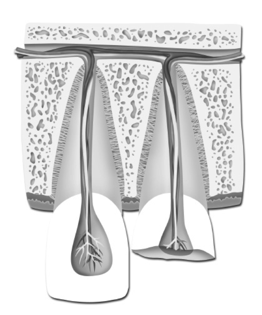 Broken tooth