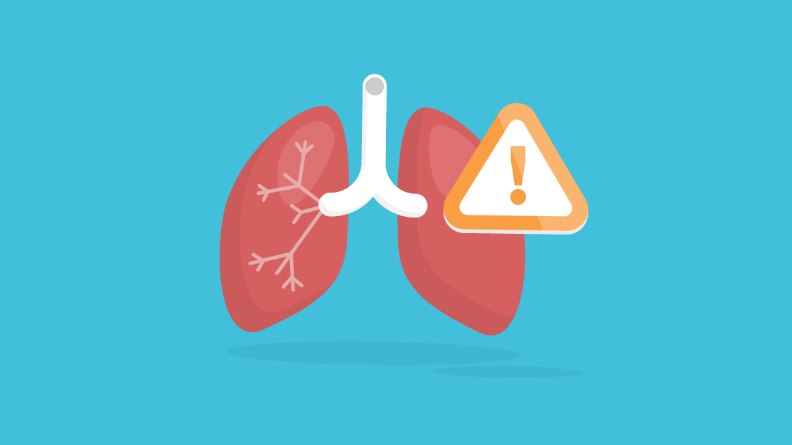 Lung cancer risk factors.png