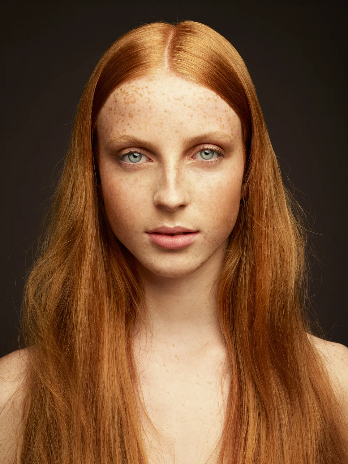 FRECKELS
