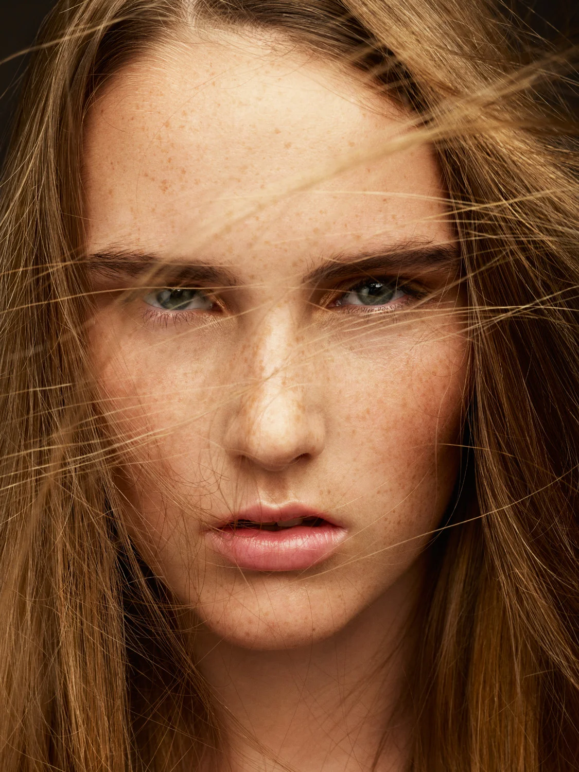 FRECKELS