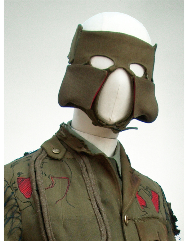 4. Face piece with scalp flaps turned forward to graft cheeks.jpg