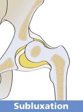 Swaddling Your Baby Correctly