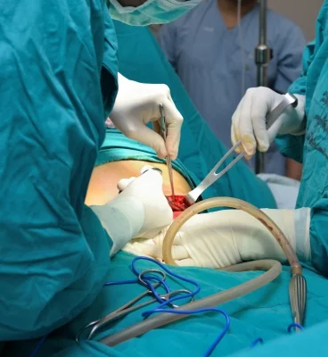 How to Avoid a Cesarean: Atlanta Hospital C-Section Rates