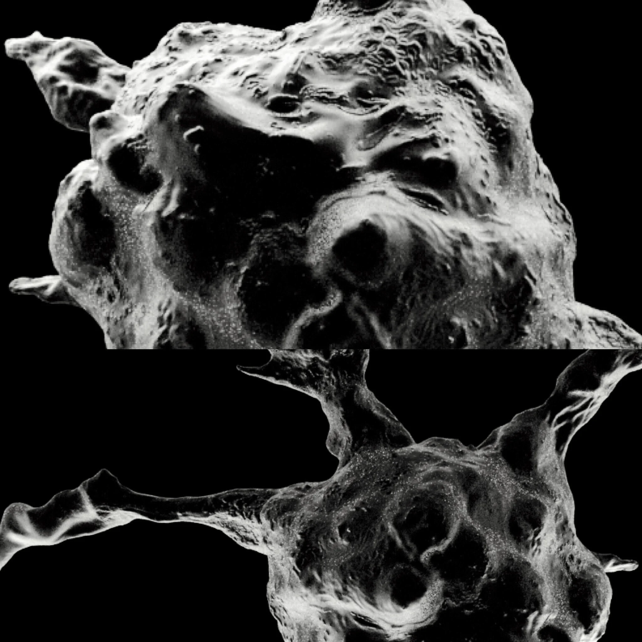 Tumor_Phase2.JPG