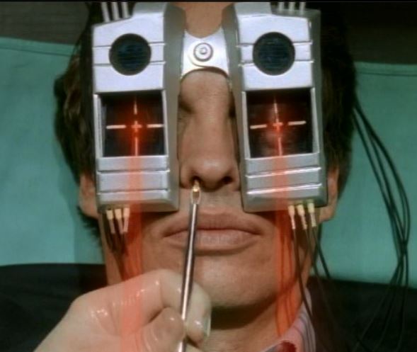 The need for lasers? Never adequately explained.