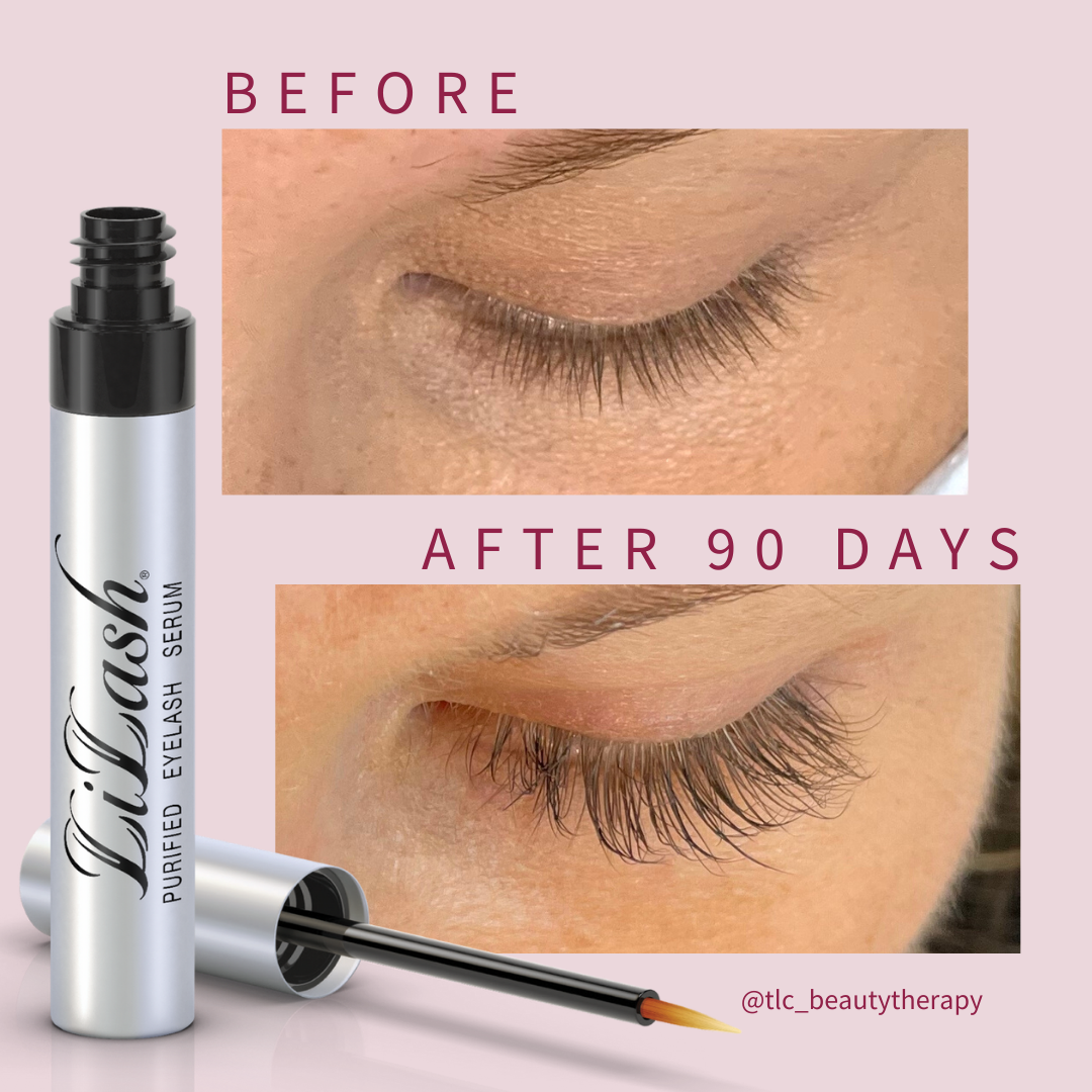 LiLash eyelash growth serum results