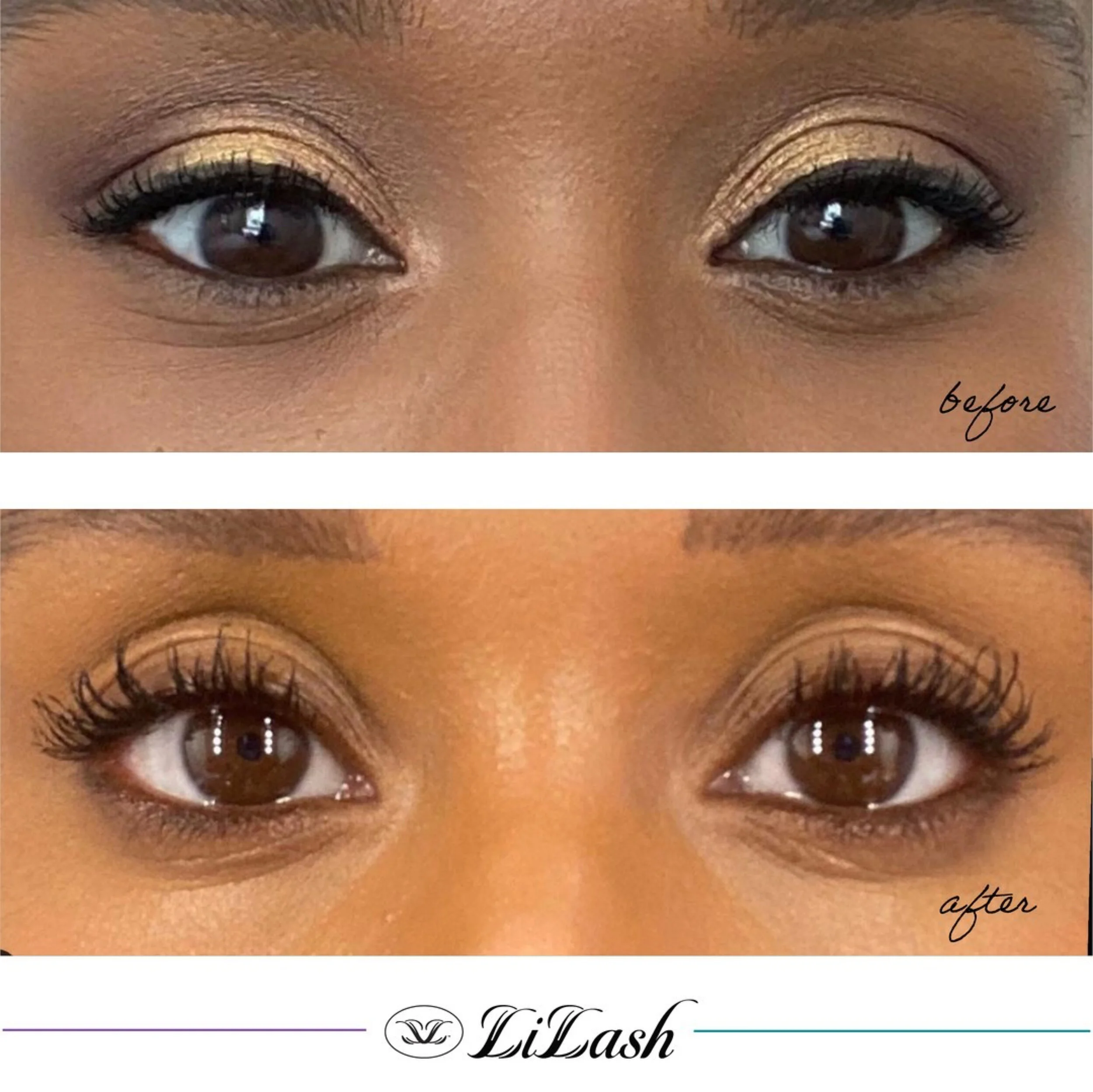 LiLash Lash Serum before and after results