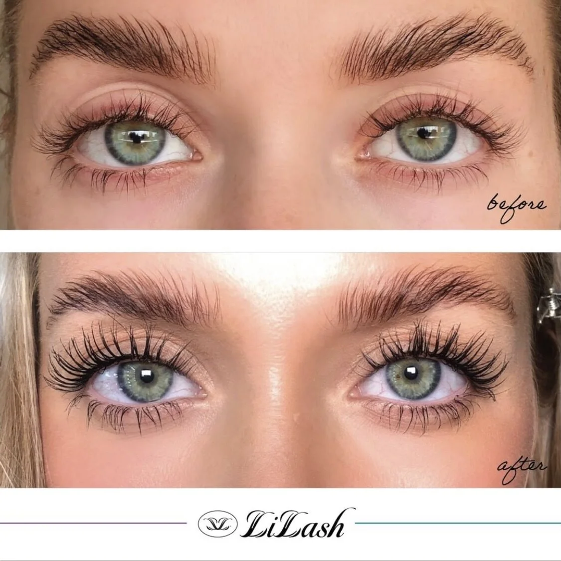 LiLash Purified Eyelash Serum SUBSCRIPTION TLC Beauty Therapy LiLash Purified Eyelash Serum SUBSCRIPTION TLC Beauty Therapy