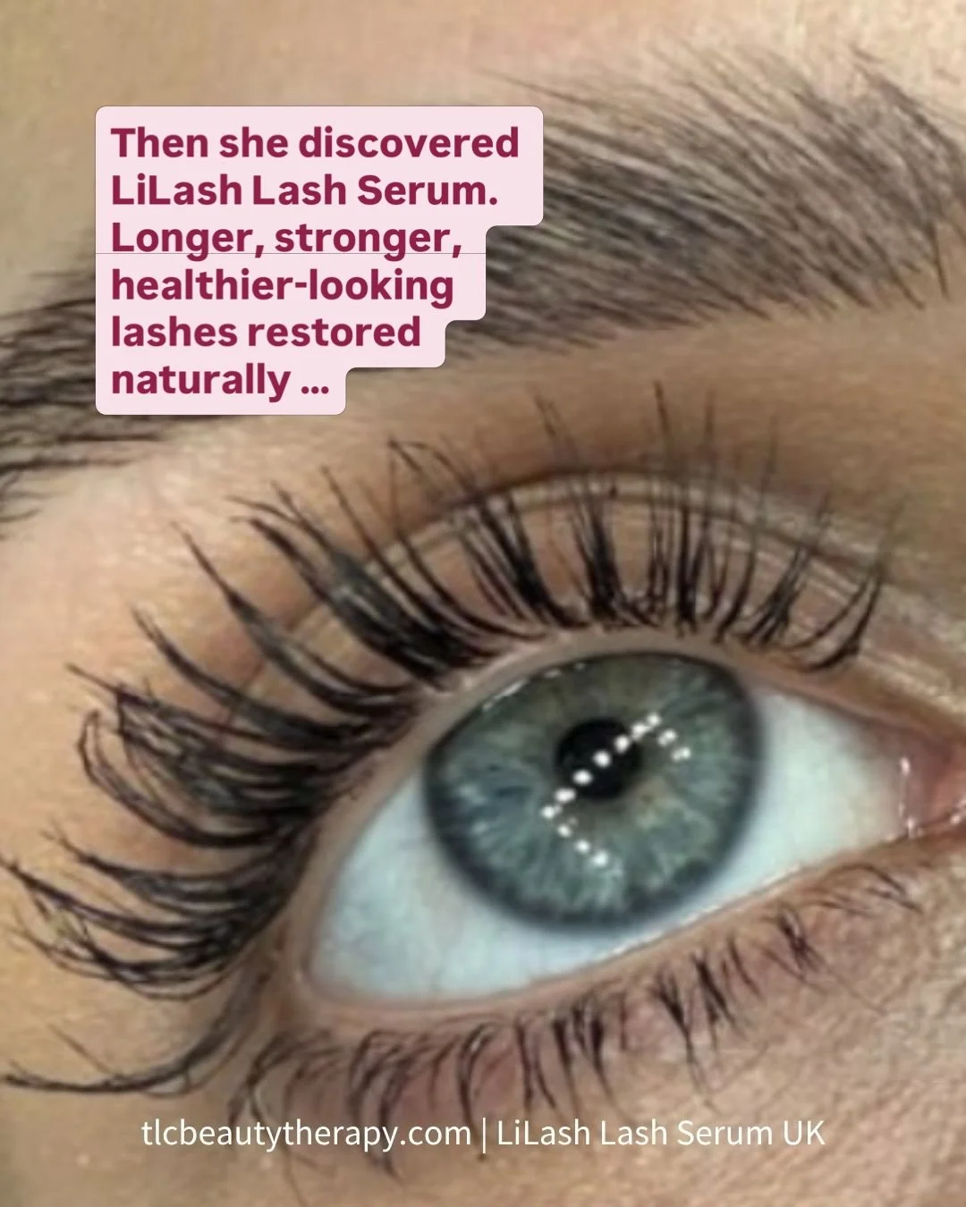 Have you ever resorted to the quick fix of eyelash extensions, only to be left with damaged, sparse or weakened natural lashes afterwards?

Don&rsquo;t worry &ndash; help is at hand 🙌

@carlijayne_ was left with very few lashes after her extensions 
