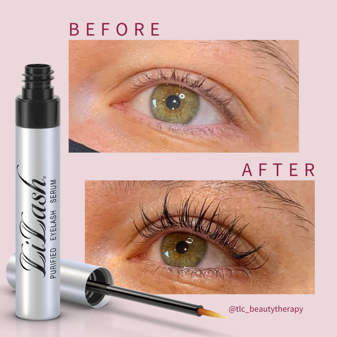 LiLash Purified Eyelash Serum before and after results
