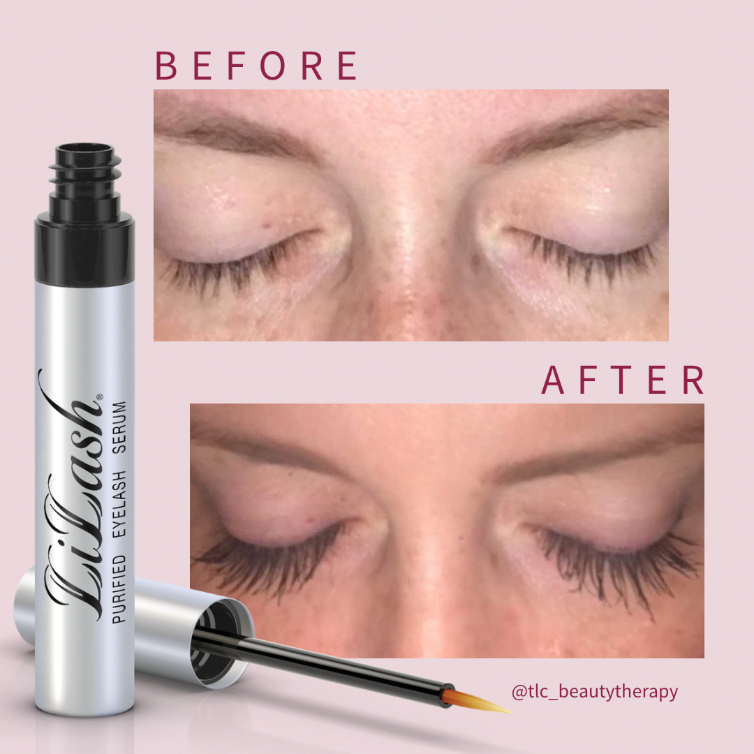 LiLash Purified Eyelash Serum before and after results
