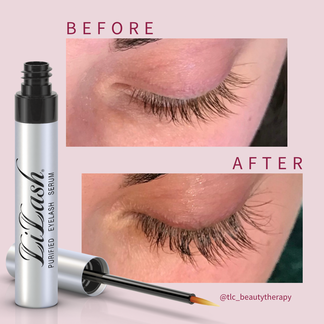 LiLash Purified Eyelash Serum before and after results
