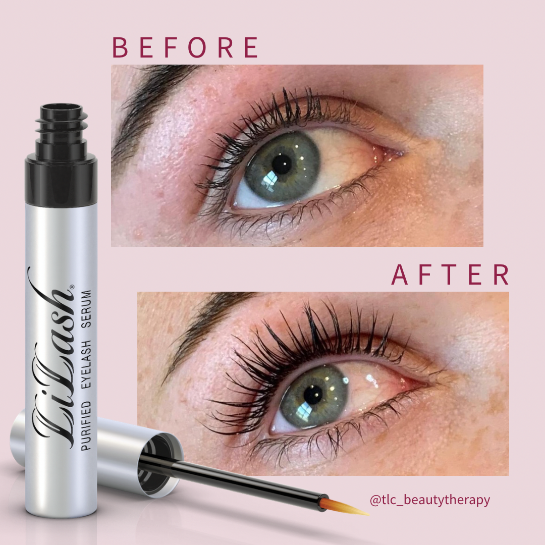 LiLash Purified Eyelash Serum before and after results