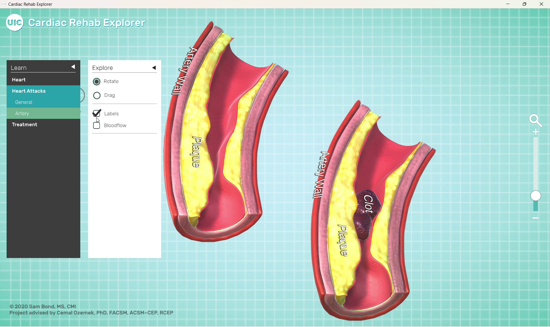 cardiac-rehab-explorer-03-arterial-disease-comparison.png