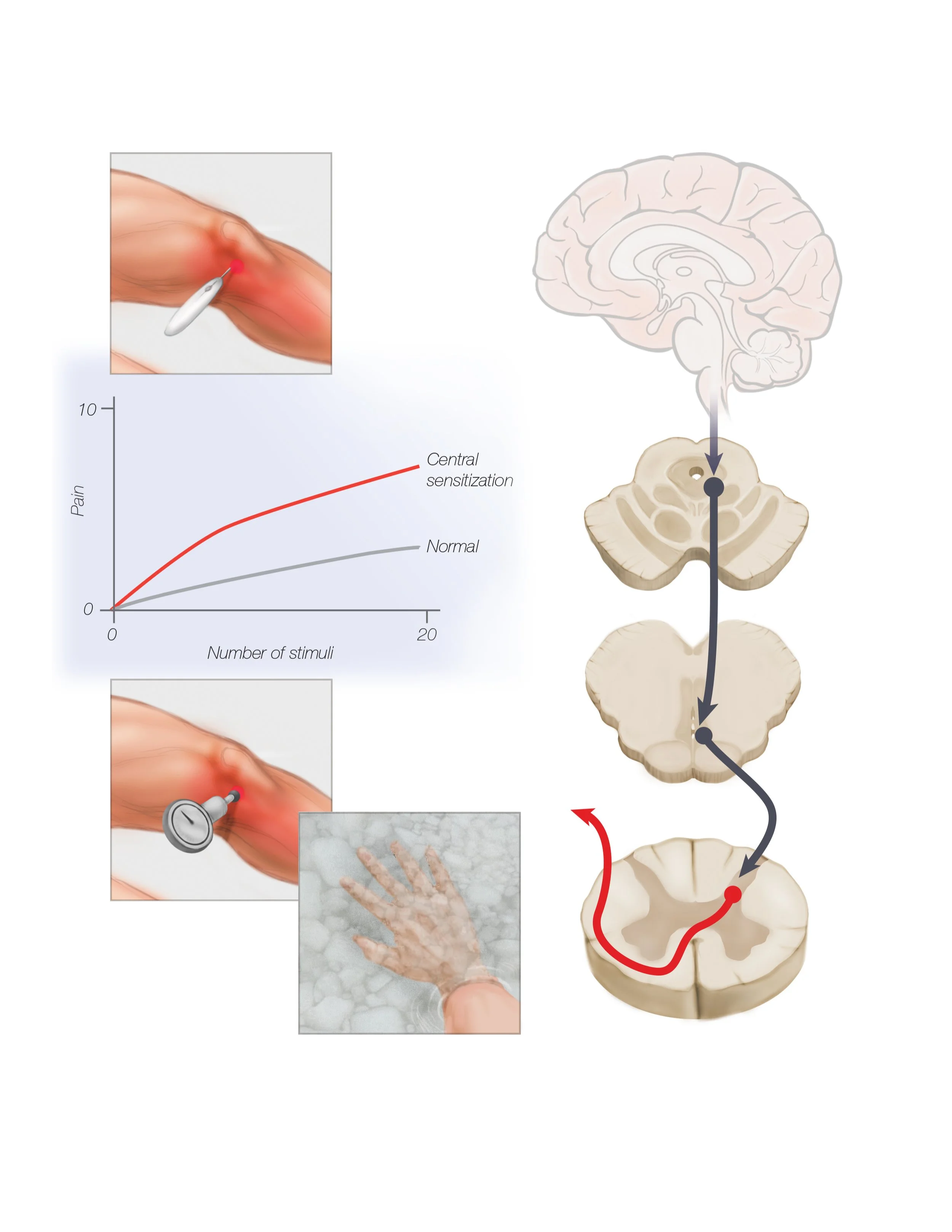 Academic Figure - ALS Research