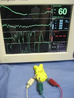 As you can see from the above readings, peeps aren't easy to monitor under anesthesia as ekg readings are difficult to interpret