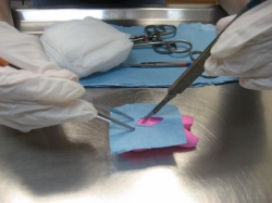 Peep surgery is easy to do but hard to do well