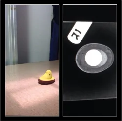 This peep ate a penny (X-rays confirm it)