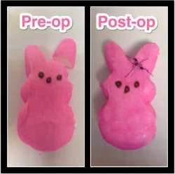 Another happy peep patient