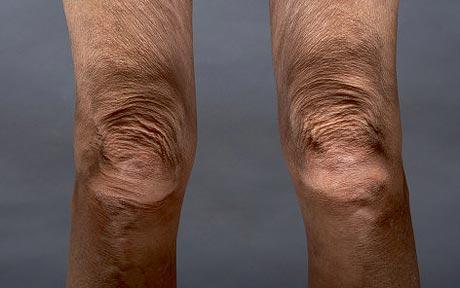knees_1480949c.jpg