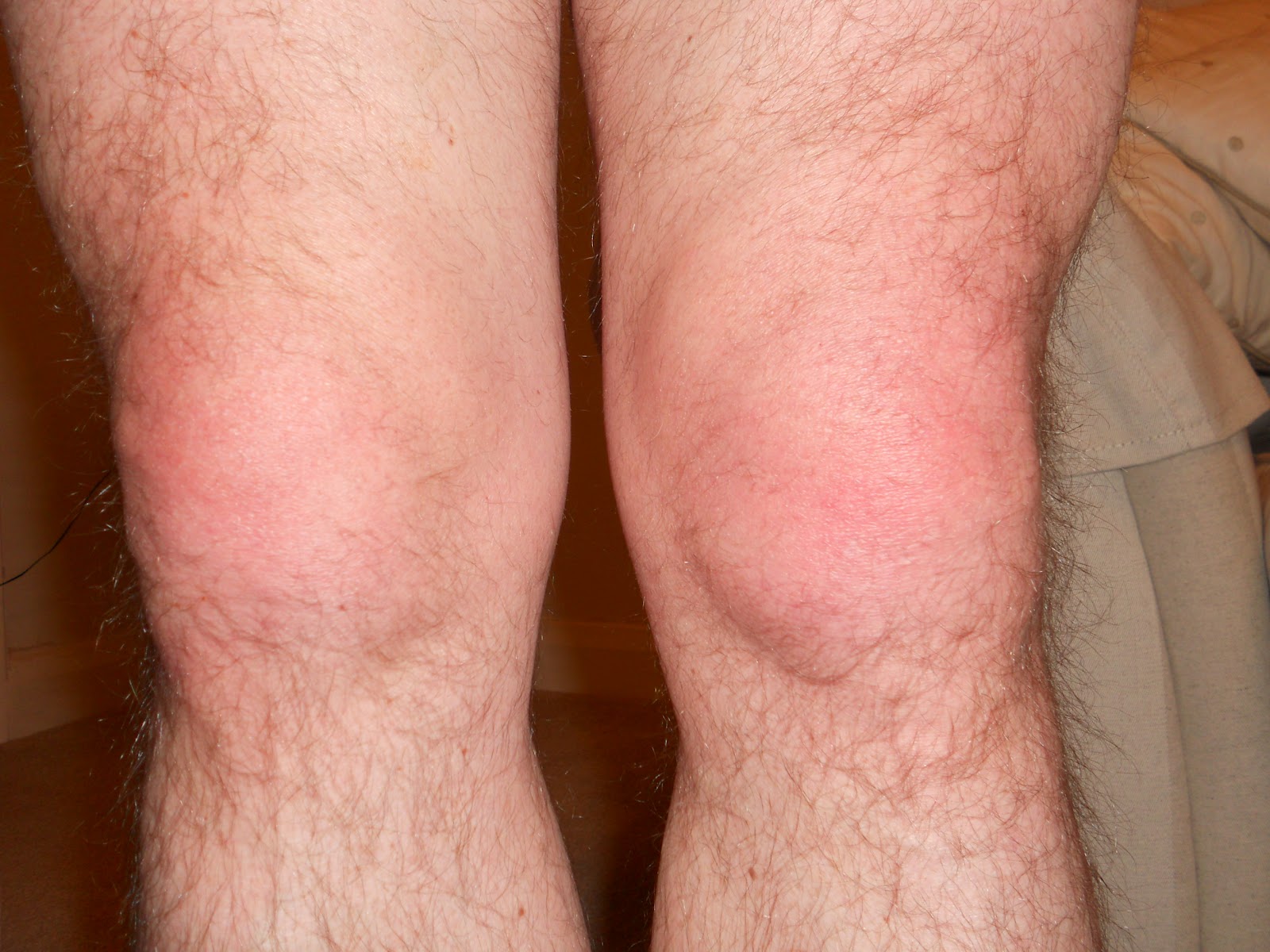 knees.jpg