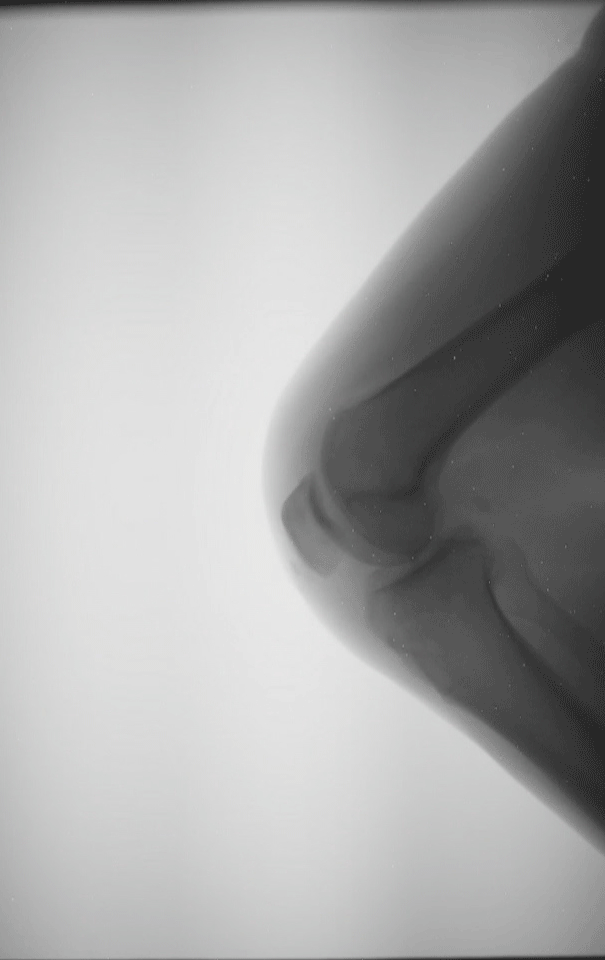 Addiss-Motion-Knee3.gif