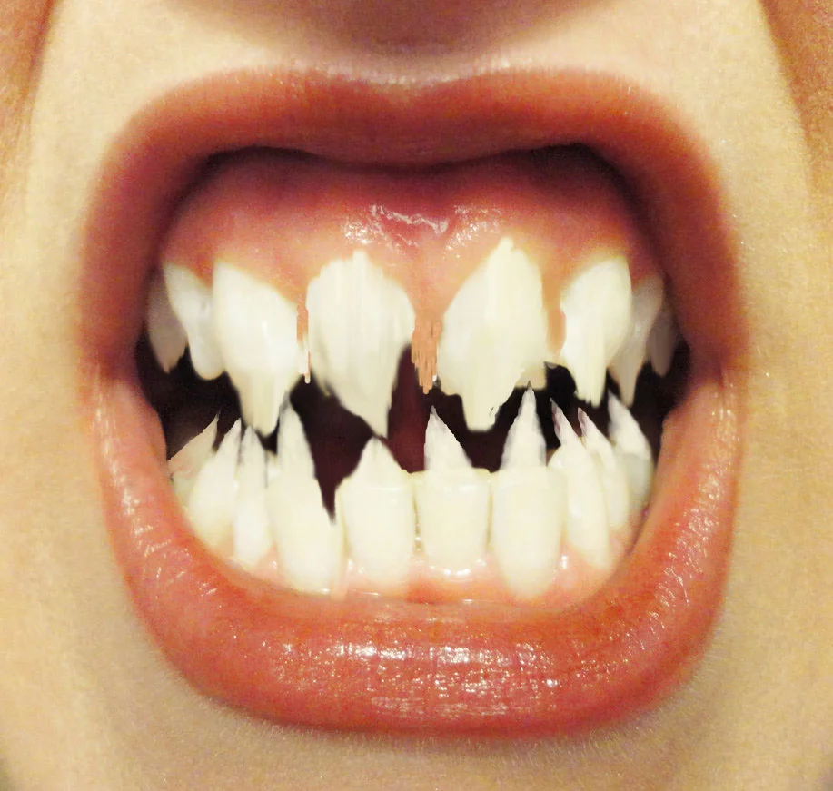 what_sharp_teeth_you_have_by_monstermaster13-d5u035g.jpg